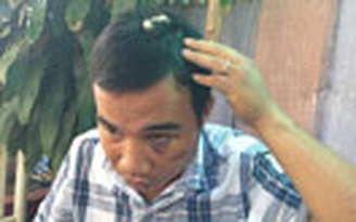 Bắt thêm 2 nghi can băng bắt cóc tống tiền, thu giữ súng và roi điện